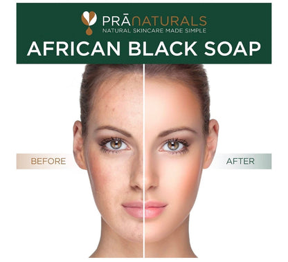 PraNaturals African Black Soap 200g | Organic Raw Ghana Soap
