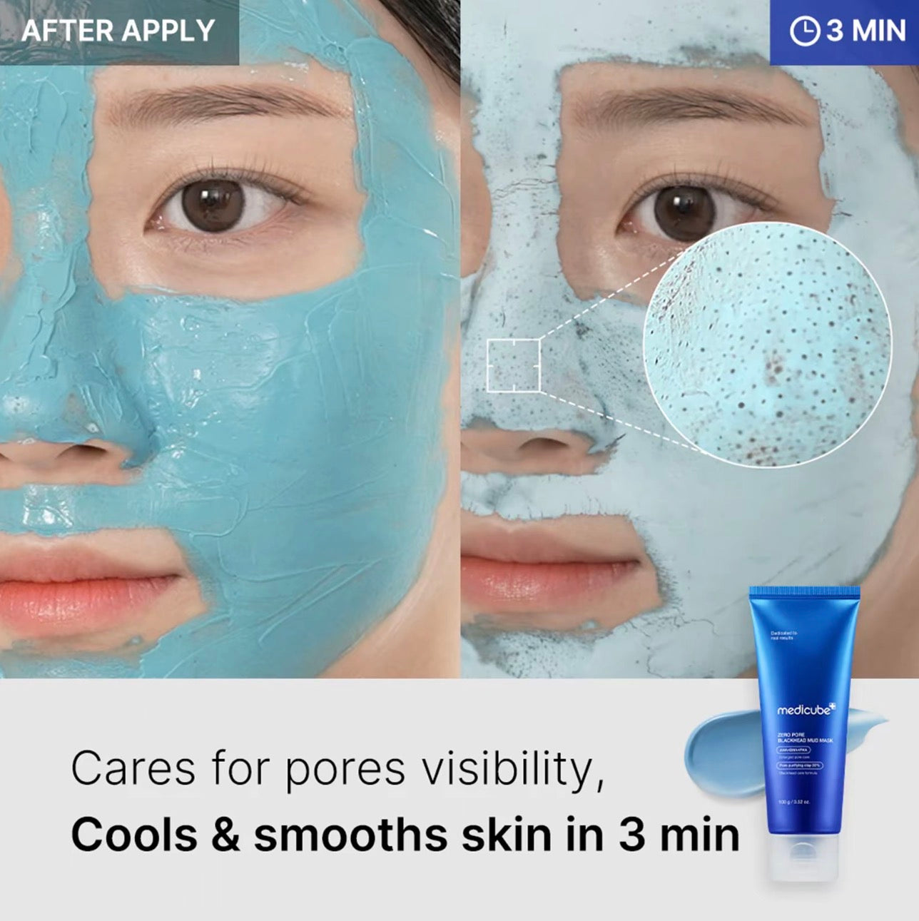 medicube Pore-fect Set Deep Pore Cleansing Mud Mask Blackhead Care