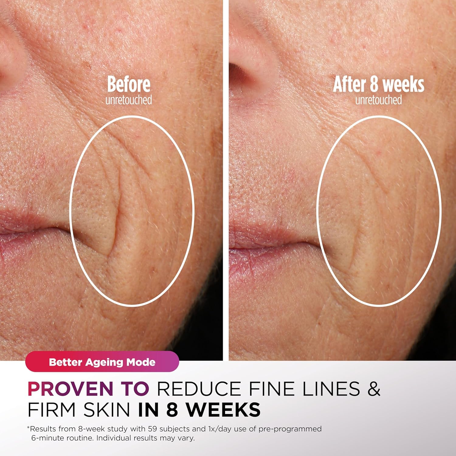 Cryoglow LED Face Mask with Under-Eye Cooling, Anti-Ageing & Blemish Repair, Red & Blue LED, Infrared Light Therapy, USB-C, Remote Control, Storage Bag, Adjustable Straps