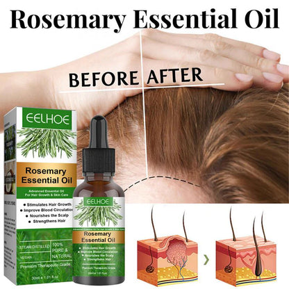 Rosemary Hair Growth Serum anti Hair Loss Products Fast Regrowth Essential Oil Repair Scalp Frizzy Thinning Damaged Hair Care