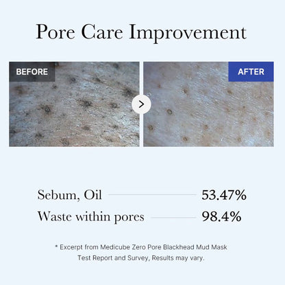 medicube Zero Pore Blackhead Mud Mask 3 Minute Pore Care Treatment