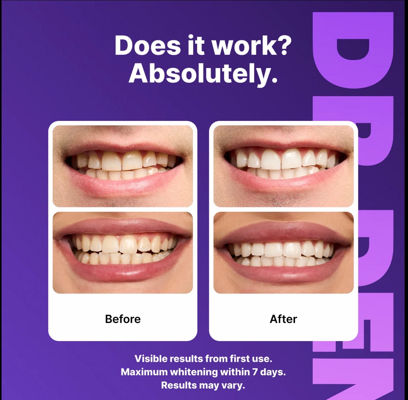 DRDENT Purple Teeth Whitening Strips Peroxide-Free