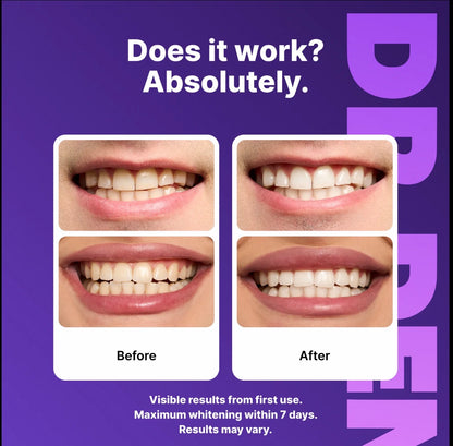 DRDENT Purple Teeth Whitening Strips Peroxide-Free