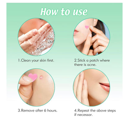 Pimple Patches Spot Patches Spot Stickers Acne Treatment Absorbing Cover Invisible Blemish Cover Acne Dots for Fast Acting Skincare