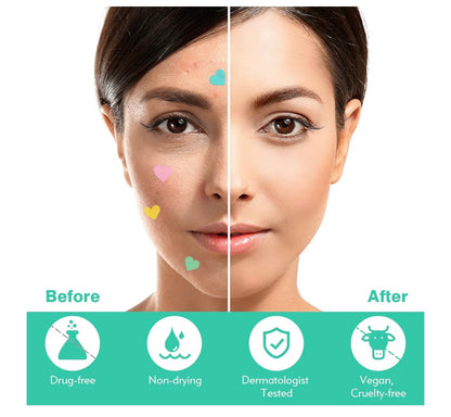 Pimple Patches Spot Patches Spot Stickers Acne Treatment Absorbing Cover Invisible Blemish Cover Acne Dots for Fast Acting Skincare