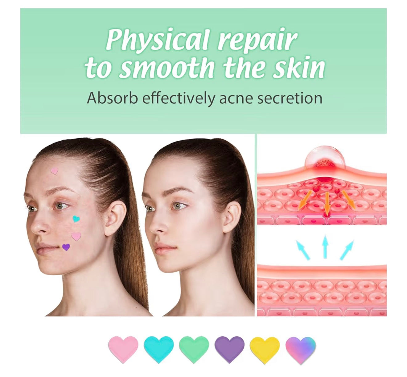 Pimple Patches Spot Patches Spot Stickers Acne Treatment Absorbing Cover Invisible Blemish Cover Acne Dots for Fast Acting Skincare