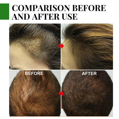 Rosemary Hair Growth Serum anti Hair Loss Products Fast Regrowth Essential Oil Repair Scalp Frizzy Thinning Damaged Hair Care